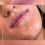  مرکز لیزر و کلینیک زیبایی سینوهه