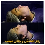 کلینیک زیبایی و لیزر موهای زائد ابریشم