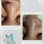  مرکز تخصصی فیشال و ماساژ کیمیا