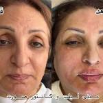  کلینیک پوست مو زیبایی دکتر نیلوفر مریمی