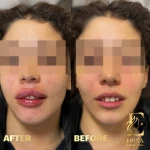  کلینیک زیبایی پوست مو لیزر اریکا