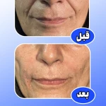 مرکز لیزر و کلینیک پوست مو زیبایی ژوبل