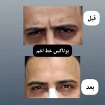 کلینیک لیزر و زیبایی راشا