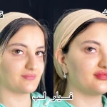  کلینیک پوست مو زیبایی دکتر نیلوفر مریمی