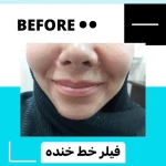  مركز ليزر و لاغري آيسان