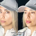 کلینیک پوست مو زیبایی دکتر نیلوفر مریمی