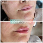 کلینیک زیبایی دکتر نینا قلی زاد