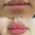 کلینیک پوست مو زیبایی و لیزر آسمانه