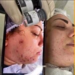  فیشیال و پاکسازی پوست رخشید