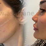  کلینیک پوست مو زیبایی و لیزر آسمانه