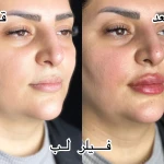 کلینیک پوست مو زیبایی دکتر نیلوفر مریمی