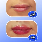  مرکز لیزر و کلینیک پوست مو زیبایی ژوبل