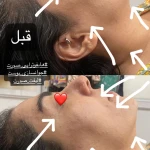 مرکز لیزر و کلینیک زیبایی آیسان