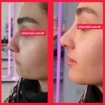  مرکز تزریق چربی و لیزر بدن شمس آباد