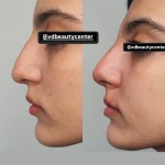 کلینیک زیبایی پوست مو و زیبایی V&D