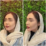  کلینیک زیبایی لاغری لیزر زیبابمون