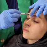 مرکز لیزر کلینیک زیبایی و بوتاکس یاسمینا