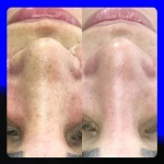 سالن تخصصی پاکسازی پوست سمیه ملکی