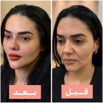  کلینیک زیبایی زارا