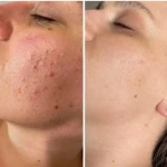  مرکز لیزر و لاغری و زیبایی آنیدا