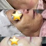 مرکز لیزر و کلینیک زیبایی موگه