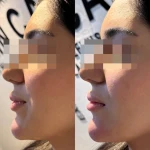 کلینیک زیبایی پوست مو لیزر اریکا
