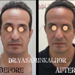 مرکز لیزر کلینیک زیبایی و بوتاکس یاسمینا