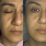 مرکز لیزر و کلینیک زیبایی موگه