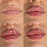 کلینیک زیبایی و لیزر دکتر رز