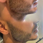 کلینیک پوست مو زیبایی و لیزر آسمانه
