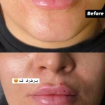  مرکز زیبایی بوتاکس و ژل و لیزر نایس