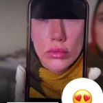 مرکز لیزر، پوست و مو نچرال بیوتی