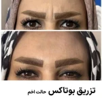 مرکز لیزر و زیبایی زروانی