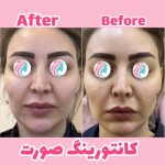  مرکز لیزر و زیبایی زروانی