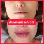 مرکز تزریق چربی و لیزر بدن شمس آباد