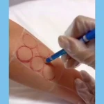  کلینیک پوست مو زیبایی و لیزر فرانه