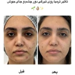 کلینیک زیبایی و مرکز لیزر آتی نو