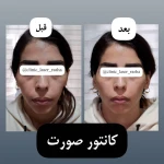 کلینیک لیزر و زیبایی راشا