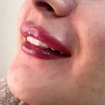 کلینیک لیزر و زیبایی نیلماه