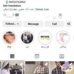 کلینیک پوست و مو زیبایی لیزر آلبا