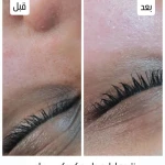 پاکسازی پوست و فیشیال الهه ماه پروی