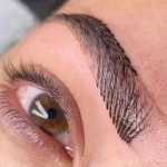 مرکز تخصصی فیشال پوست عاطفه