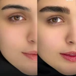 مرکز فیبروز، میکروبلیدینگ و آرایش دائم عاطفه