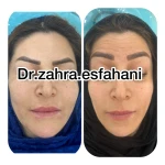  کلینیک پوست مو زیبایی دکتر زهرا اصفهانی