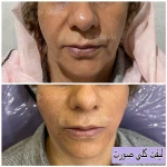  کلینیک زیبایی و بوتاکس دکتر مهشید طالبی