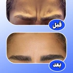  مرکز لیزر و کلینیک پوست مو زیبایی ژوبل