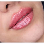 مرکز لیزر و زیبایی زروانی