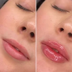 کلینیک پوست، مو و لیزر ژیوان