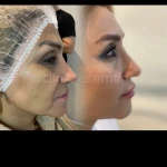  کلینیک پوست مو زیبایی و لیزر آسمانه