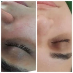 پاکسازی پوست و فیشیال الهه ماه پروی